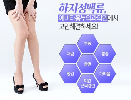 하지정맥류의 정도에 따른 시술, 수술비용 안내