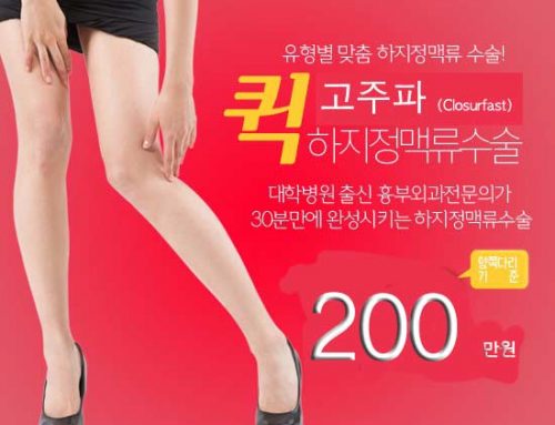 퀵! 하지정맥류 고주파 수술과 혈관경화요법의 차이, 질문과 답변
