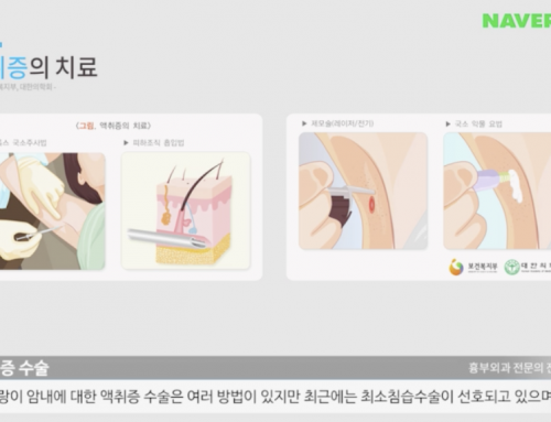 [영상상담] 겨드랑이 냄새 제거 수술에 대해서