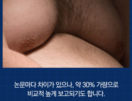 코로나 시대에 보이는 여유증