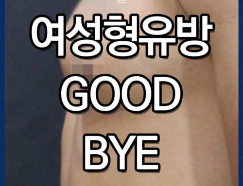 여성형유방 이제는 작별인사를!