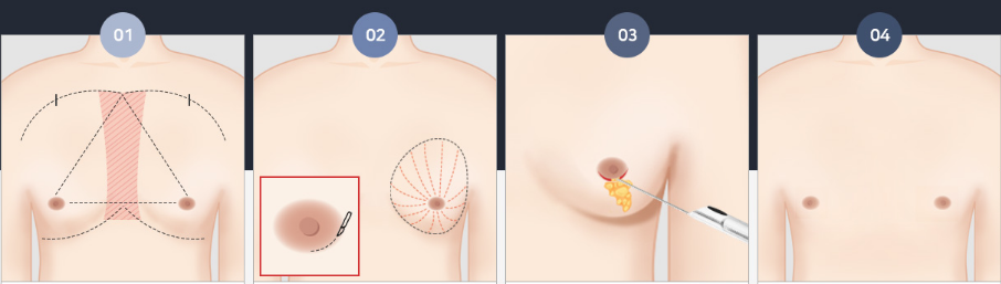 FTM_Operation_Step