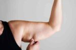 liposuction_arm_img_02 팔 지방흡입 – 에비타의원